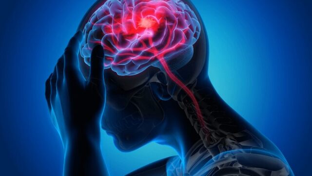 AVC durante o sono: quais sinais podem ser percebidos ao acordar?