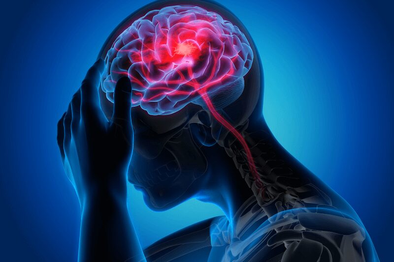 AVC durante o sono: quais sinais podem ser percebidos ao acordar?