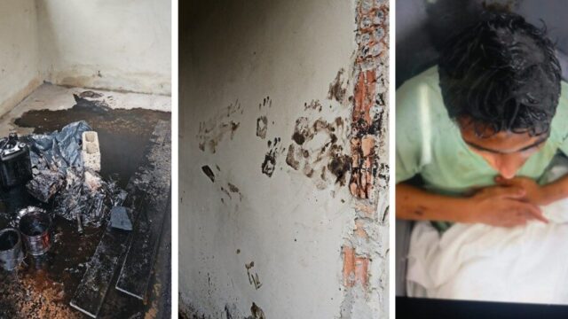 Delegado investiga possível tortura contra rapaz com deficiência na região
