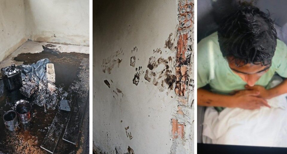 Delegado investiga possível tortura contra rapaz com deficiência na região
