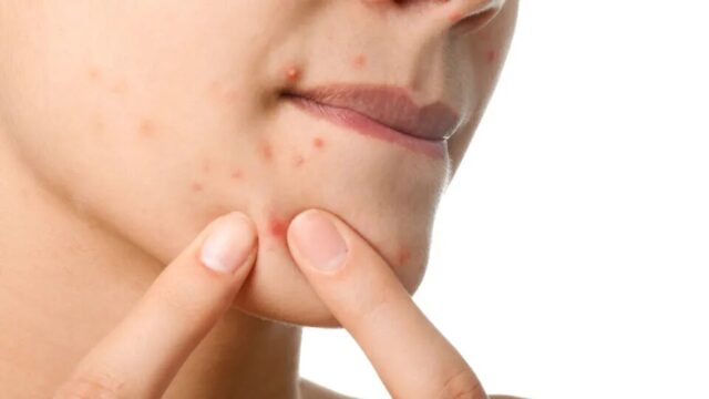 Máscara facial caseira: veja como cuidar da pele sem gastar muito dinheiro